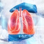 Lung Cancer Surgeon in Hyderabad