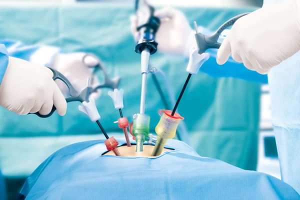 Laparoscopic Surgeon in Hyderabad performing minimally invasive surgery using advanced laparoscopic instruments.